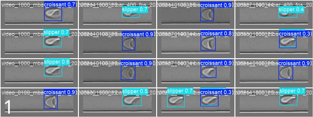 [PrePrint, WIP] Detection and Classification of Red Blood Cells under flow